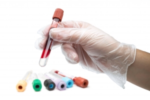 В Сухуме открыты три пункта, где граждане могут сдать анализ на антитела